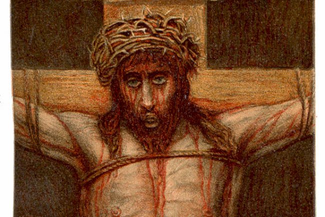 God Wants Even Your Wounds